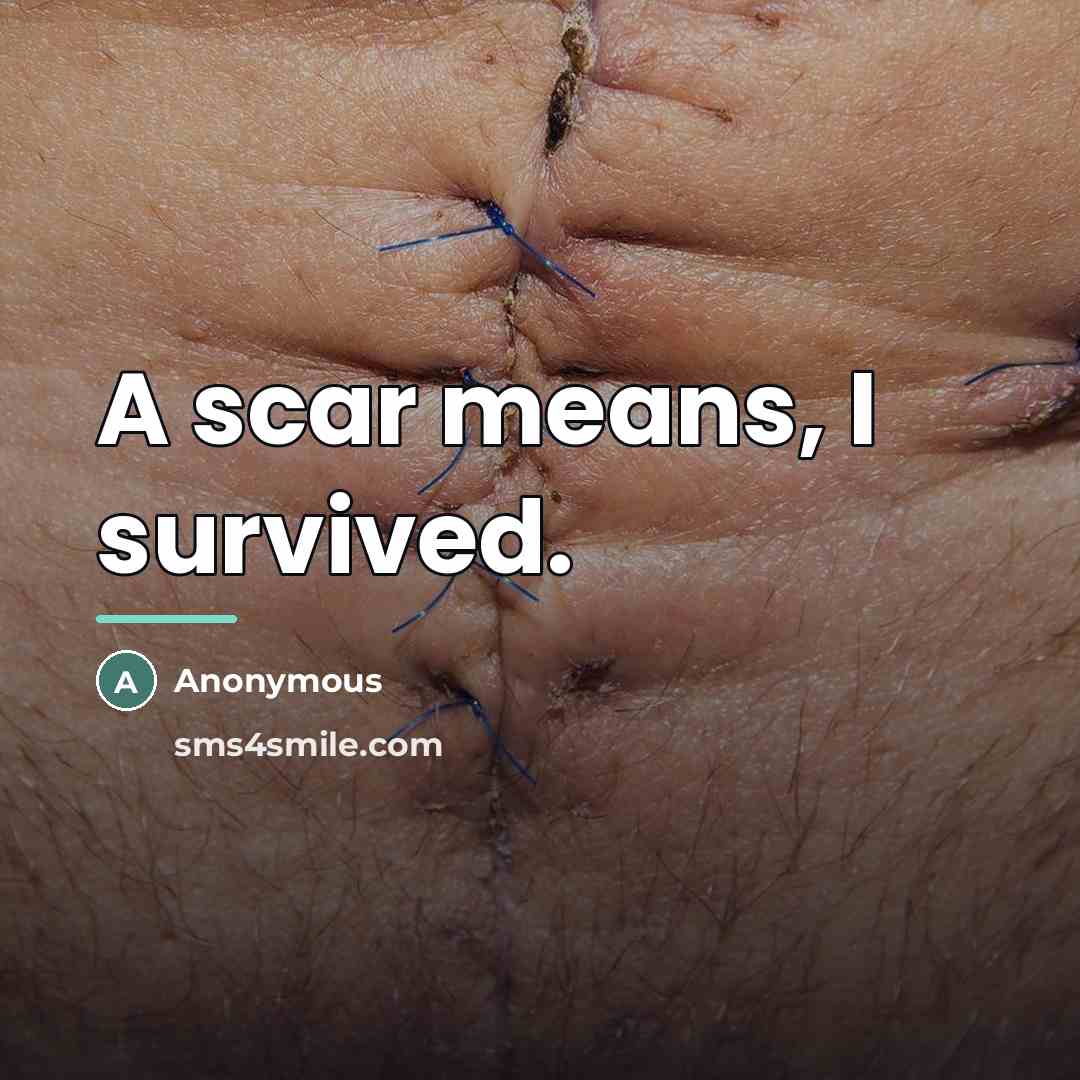 “A scar means, I survived.…” quote by Anonymous