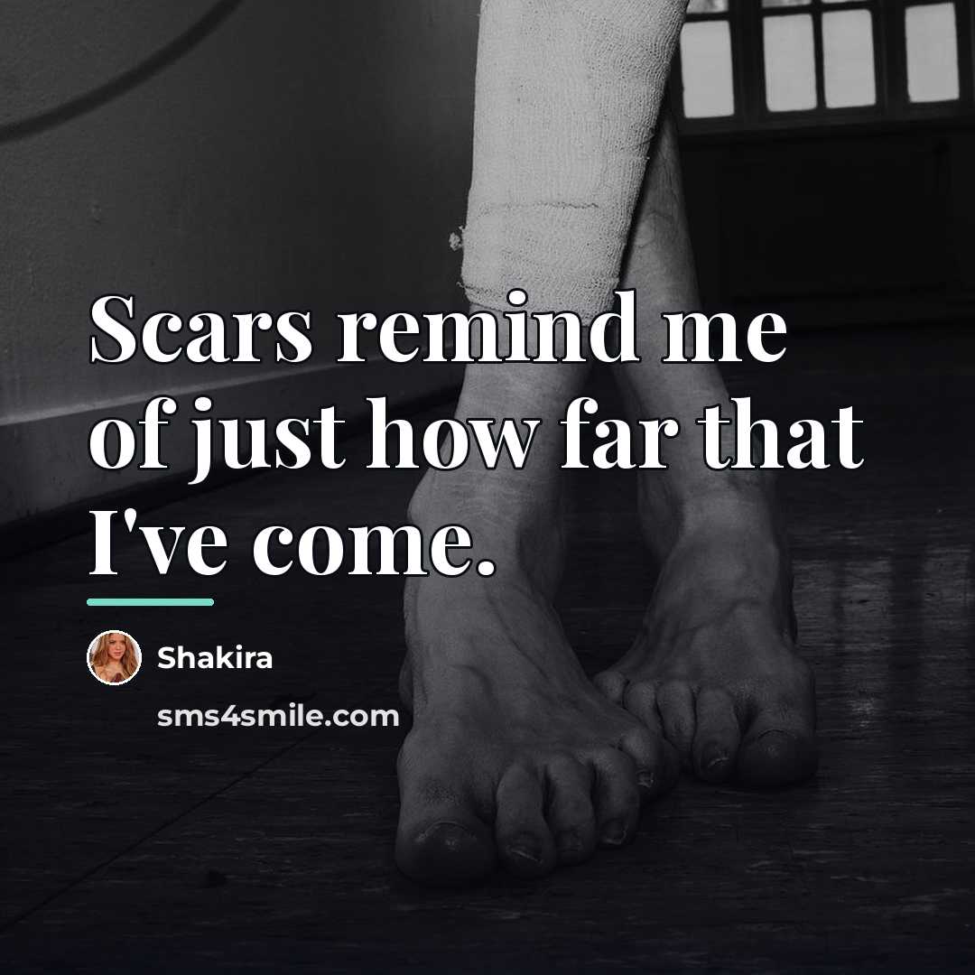 “Scars remind me of just how far that I've come.…” quote by Shakira