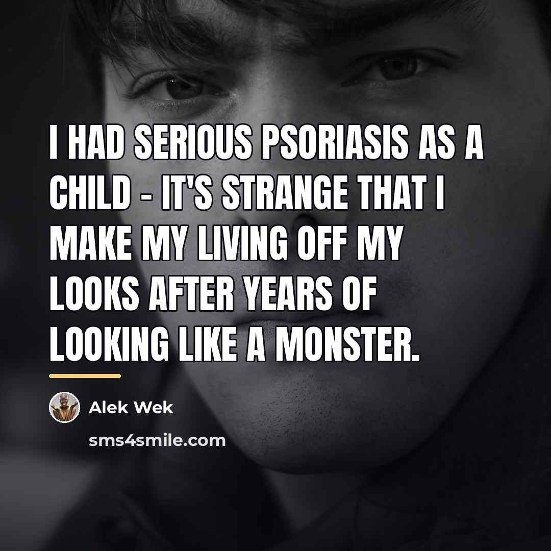 “I had serious psoriasis as a child - it's strange…” quote by Alek Wek