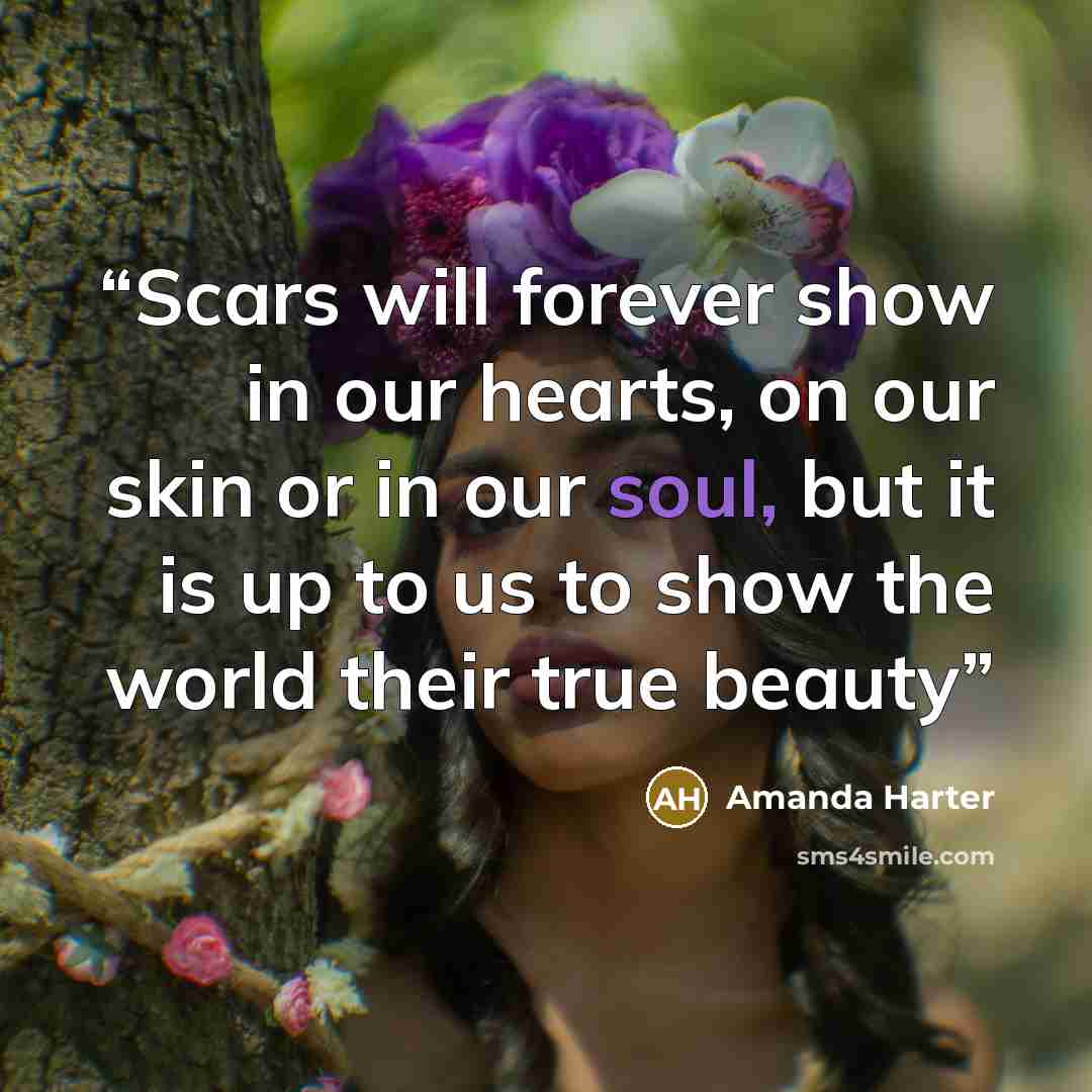 “Scars will forever show in our hearts, on our skin or in our soul, but it is up to us to show the world their true beauty” quote by Amanda Harter