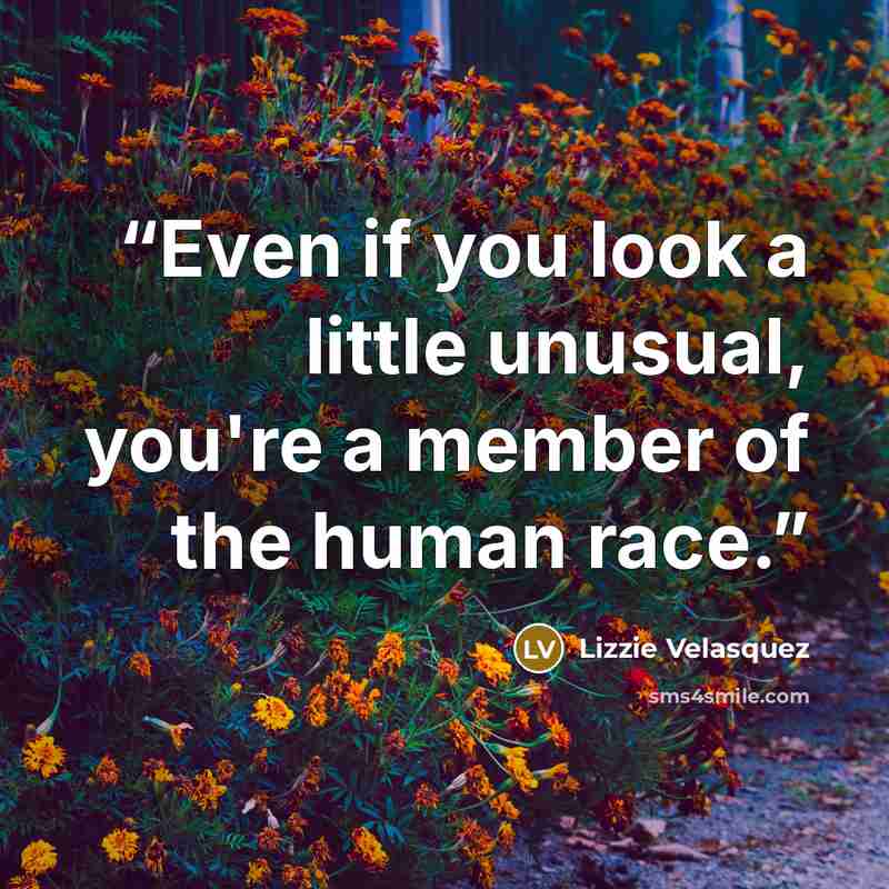 “Even if you look a little unusual, you're a member of the human race.” quote by Lizzie Velásquez