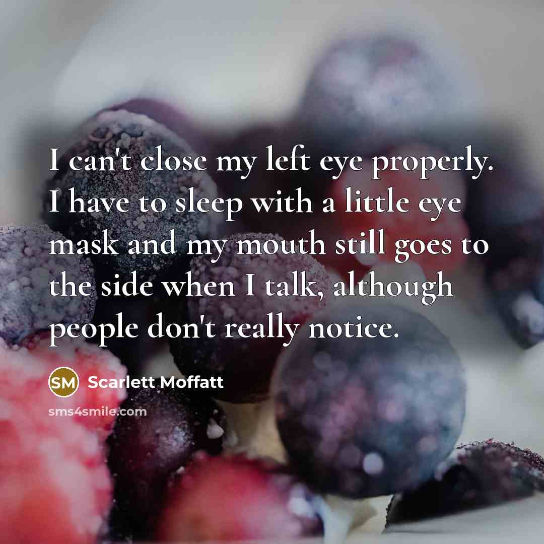 “I can't close my left eye properly. I have to…” quote by Scarlett Moffatt