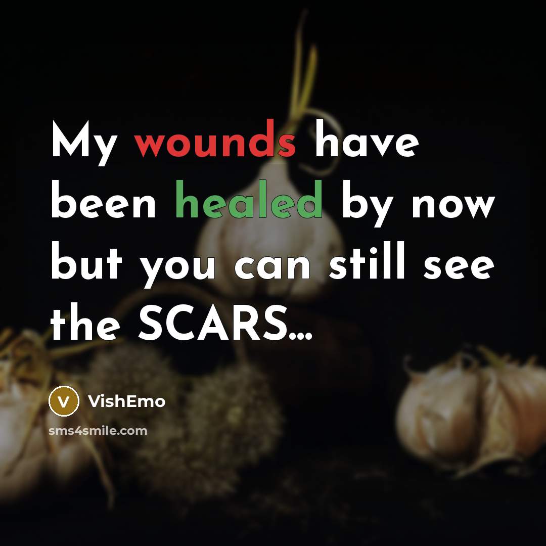 “My wounds have been healed by now but you can…” quote by VishEmo
