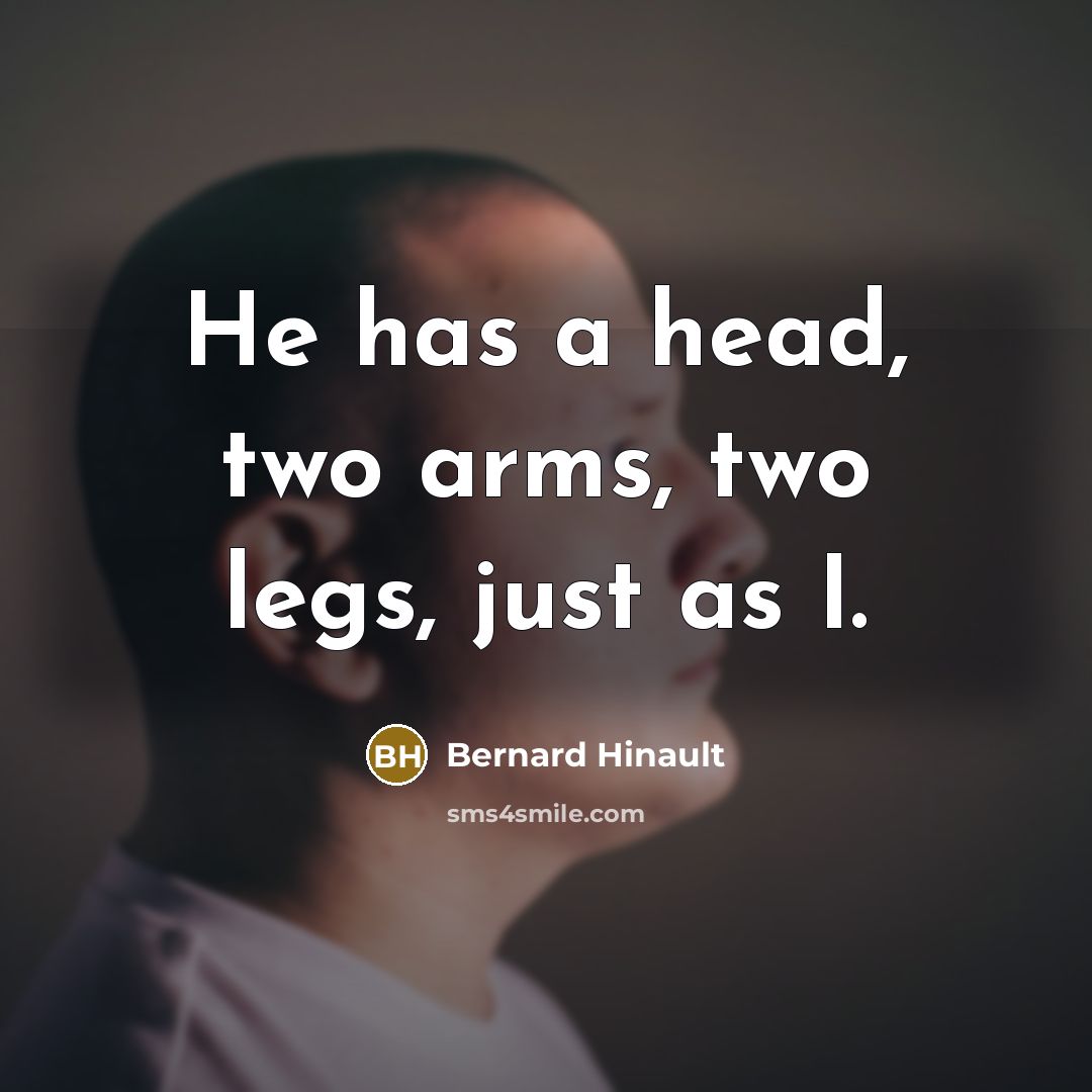 “He has a head, two arms, two legs, just as…” quote by Bernard Hinault