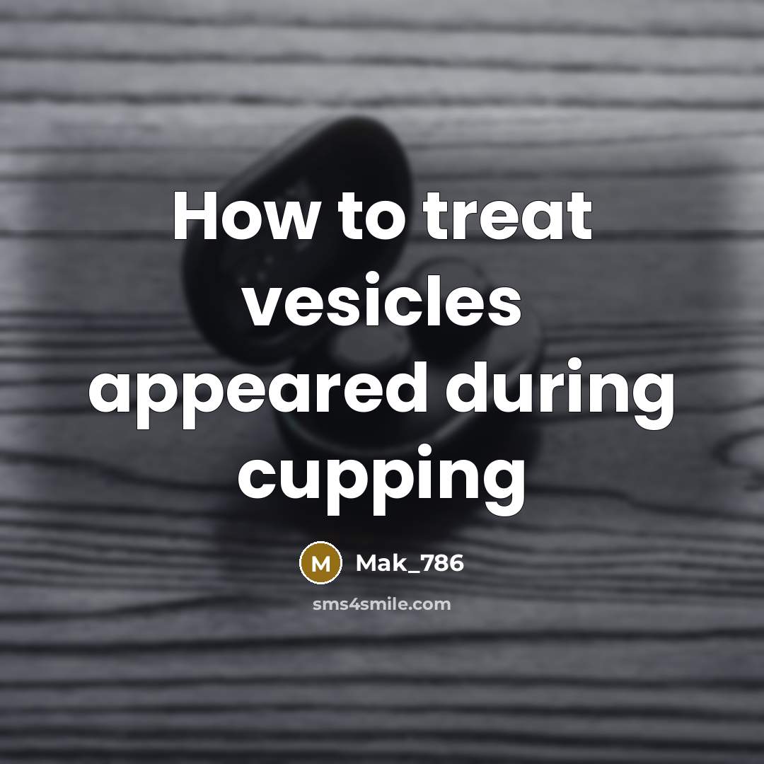 “How to treat vesicles appeared during cupping…” quote by Mak_786