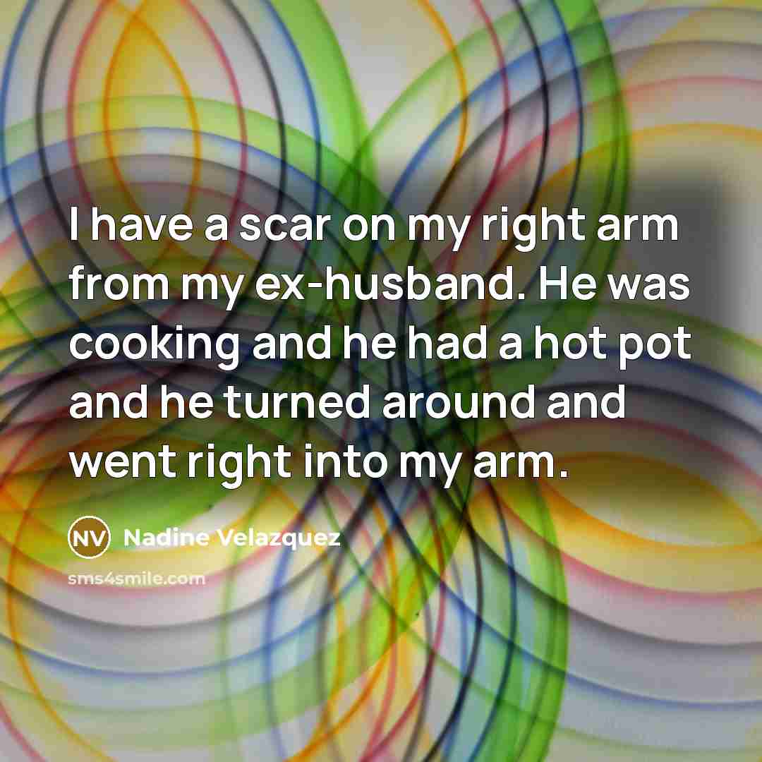 “I have a scar on my right arm from my…” quote by Nadine Velazquez