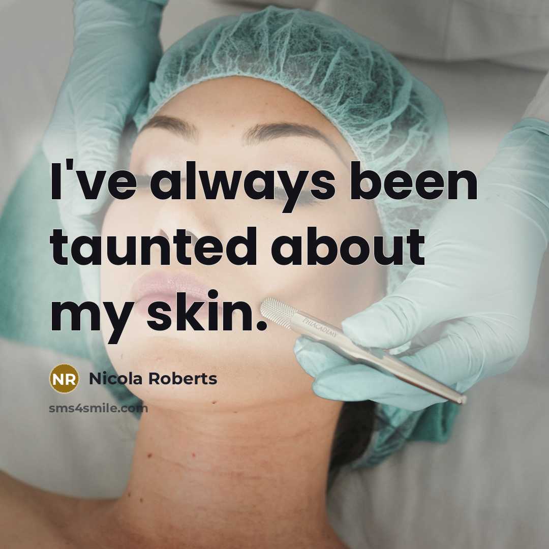 “I've always been taunted about my skin.…” quote by Nicola Roberts