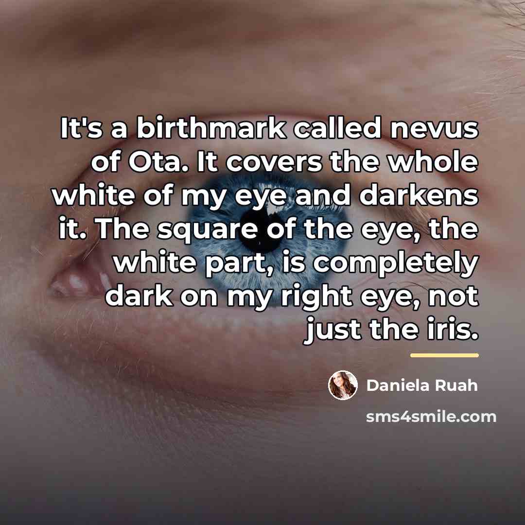 “It's a birthmark called nevus of Ota. It covers the…” quote by Daniela Ruah