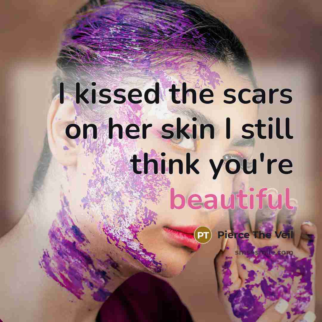 “I kissed the scars on her skin I still think…” quote by Pierce The Veil