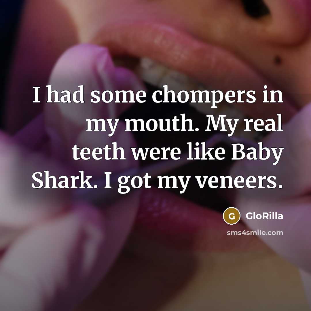 “I had some chompers in my mouth. My real teeth…” quote by GloRilla