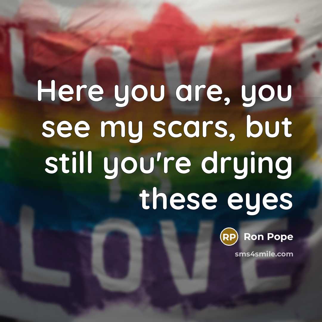 “Here you are, you see my scars, but still you're…” quote by Ron Pope