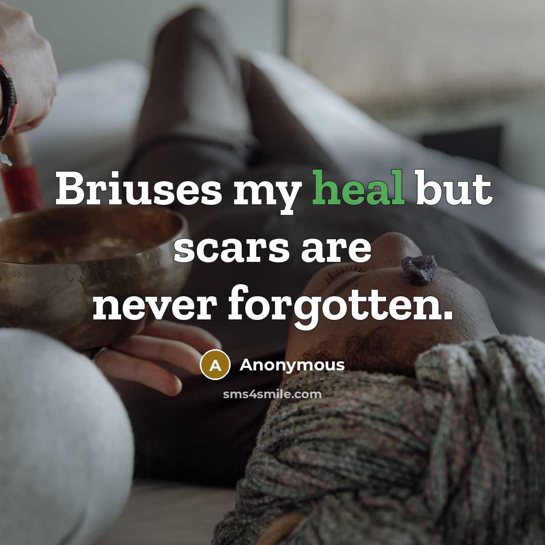 “Briuses my heal but scars are never forgotten.…” quote by Anonymous