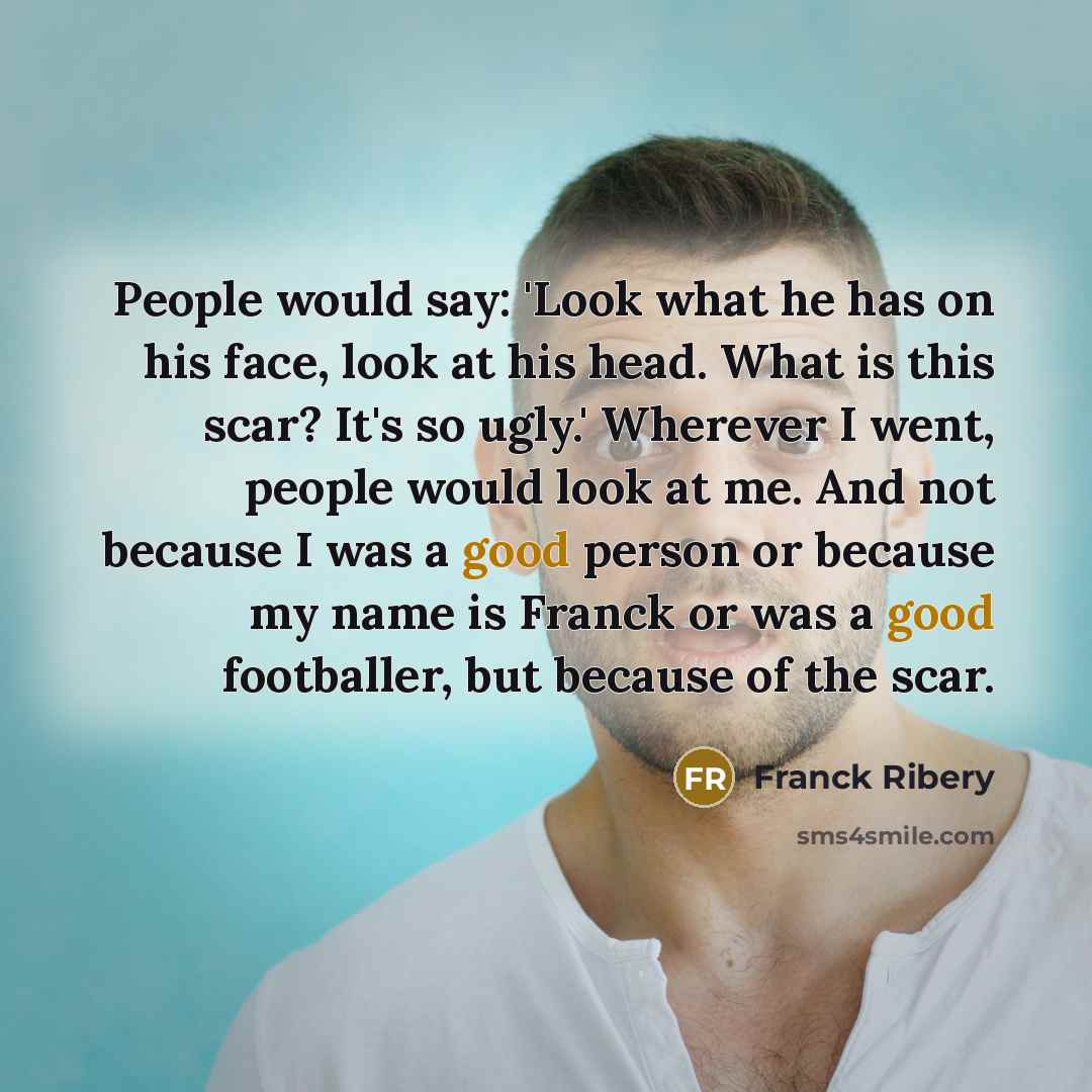 “People would say: 'Look what he has on his face,…” quote by Franck Ribery