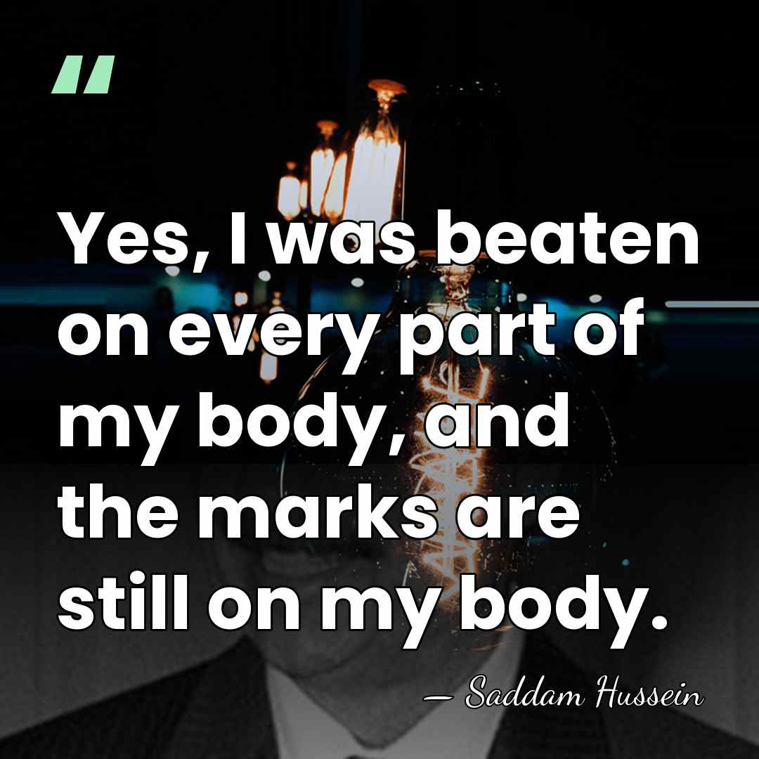 Yes, I was beaten on every part of my body, and the&hellip; - Saddam Hussein