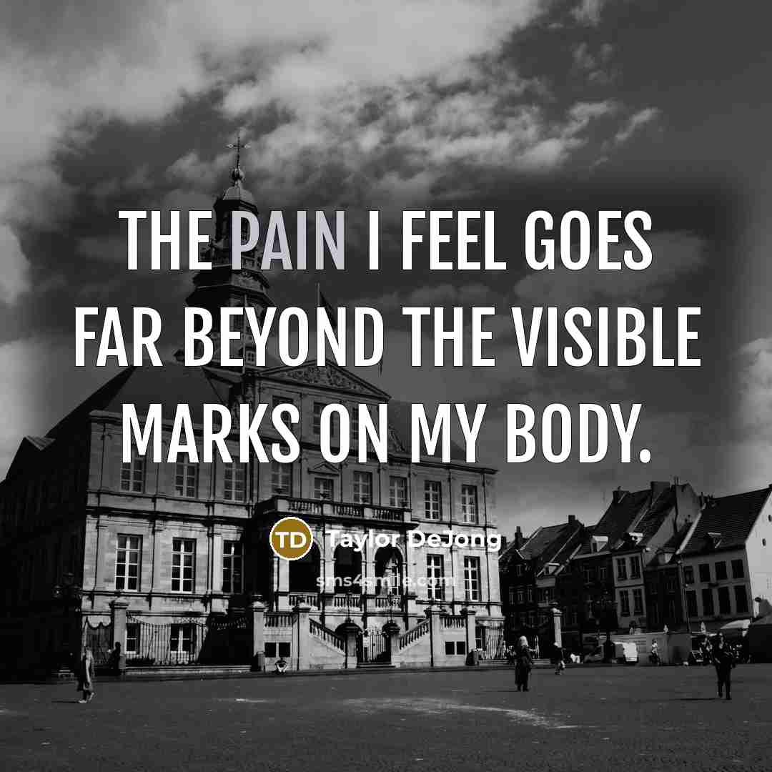 “The pain I feel goes far beyond the visible marks on my body.” quote by Taylor DeJong