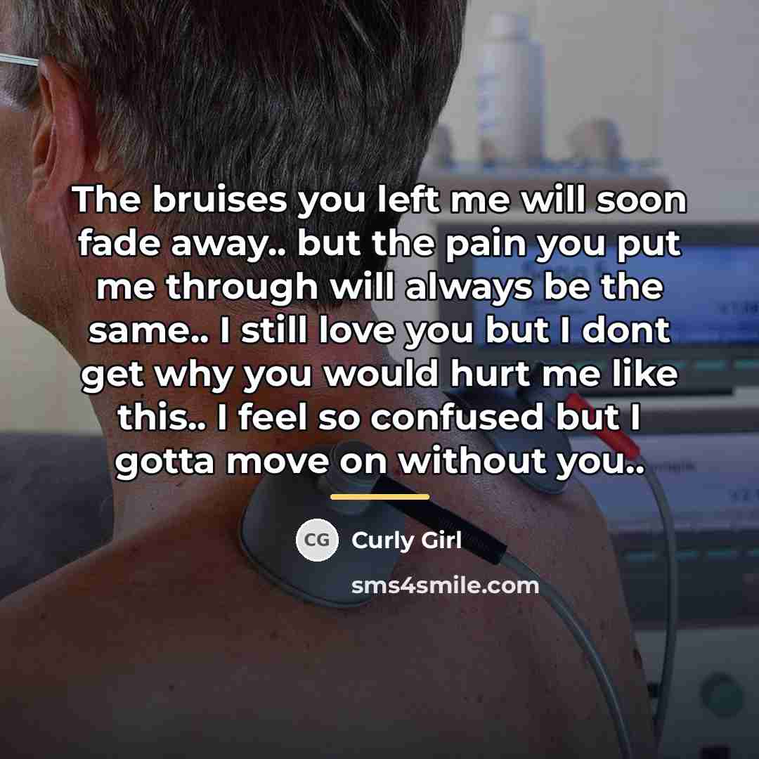 “The bruises you left me will soon fade away.. but…” quote by Curly Girl