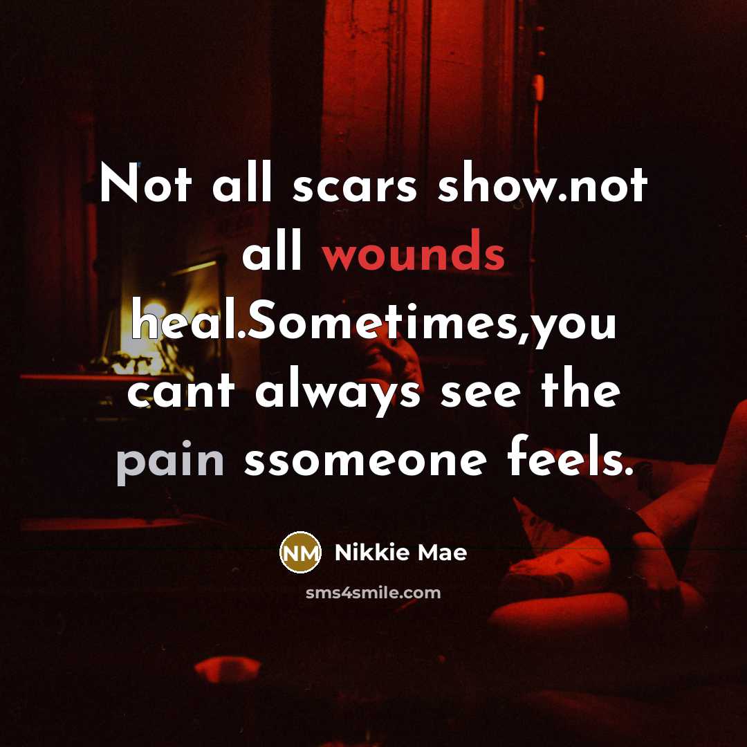 “Not all scars show.not all wounds heal.Sometimes,you cant always see the pain ssomeone feels.” quote by Nikkie Mae