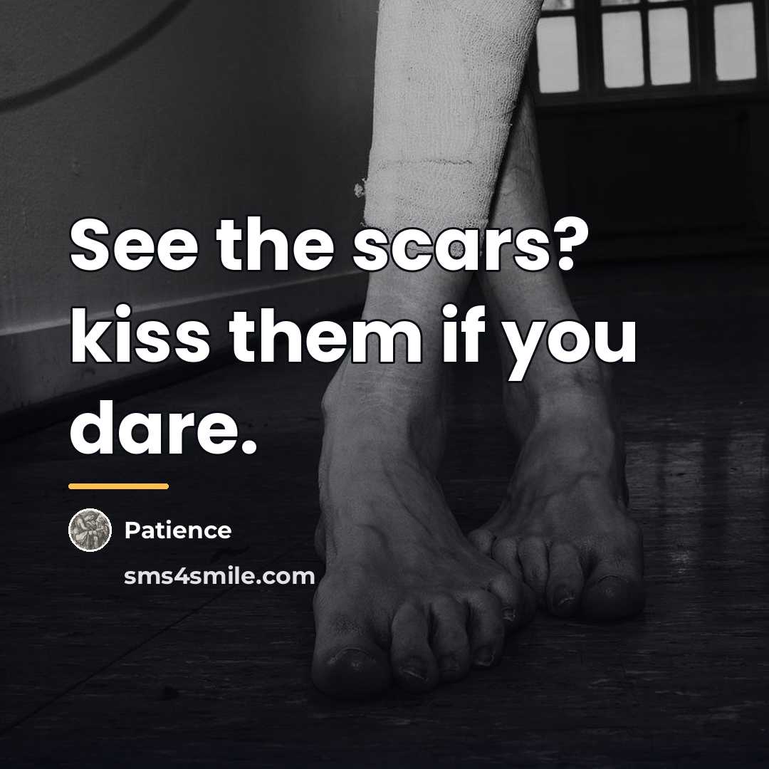 “See the scars? kiss them if you dare.…” quote by Patience