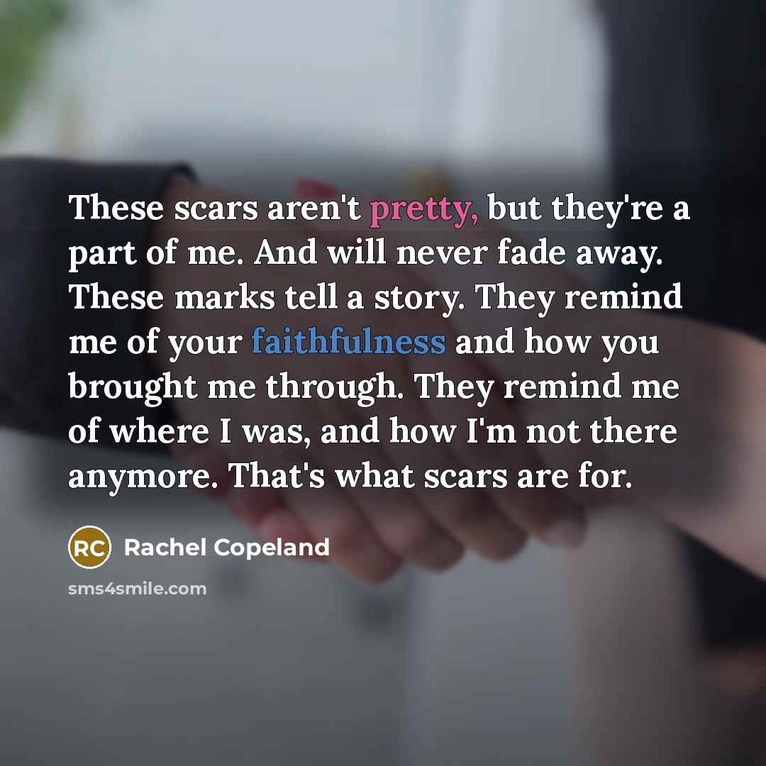 “These scars aren't pretty, but they're a part of me. And will never fade away. These marks tell a story. They remind me of your faithfulness and how you brought me through. They remind me of where I was, and how I'm not there anymore. That's what scars are for.” quote by Rachel Copeland