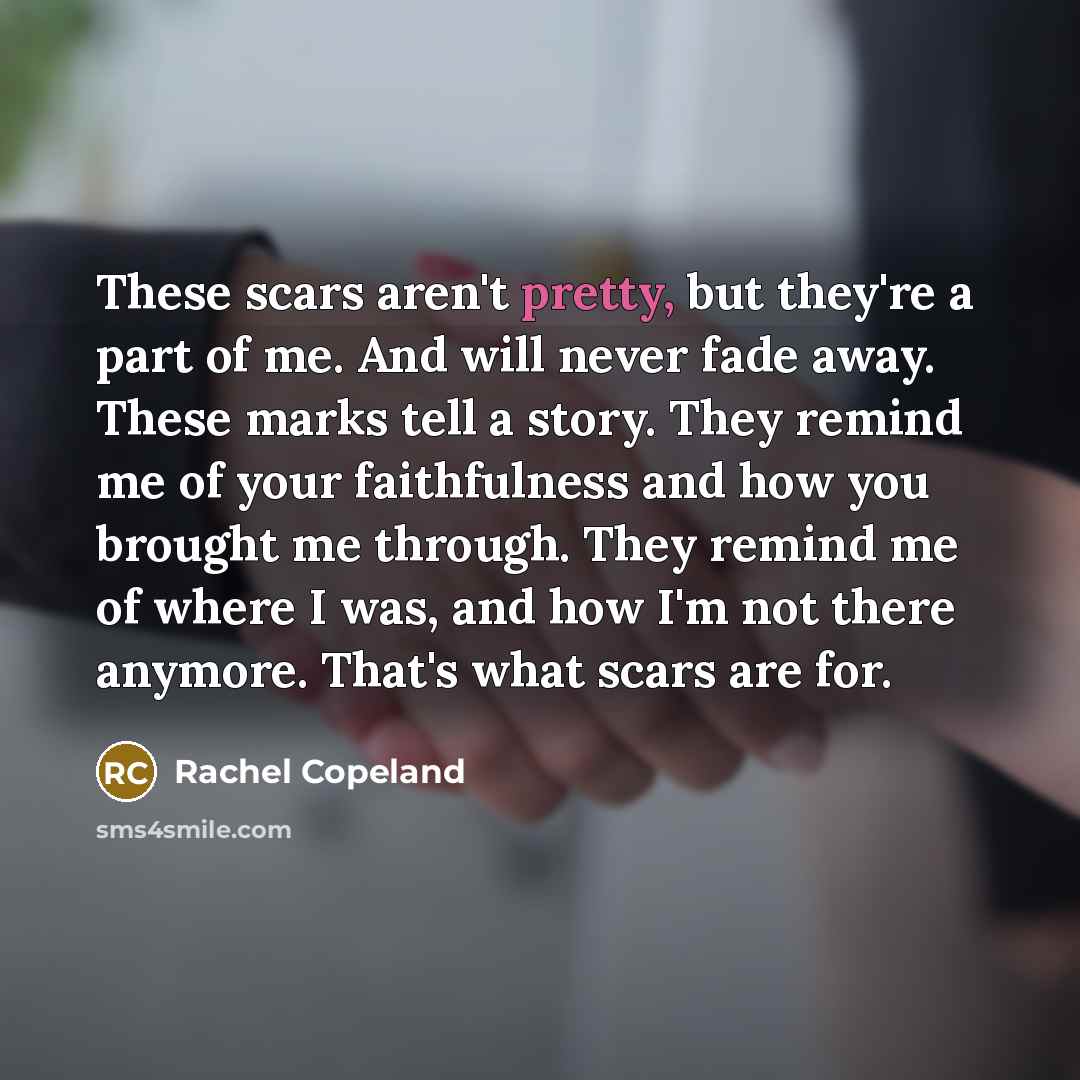 “These scars aren't pretty, but they're a part of me.…” quote by Rachel Copeland
