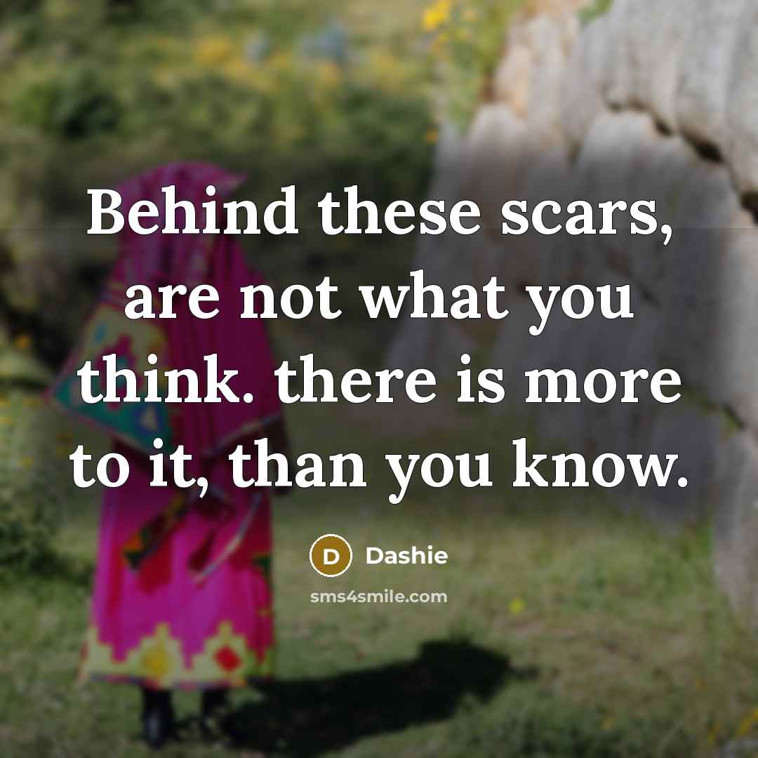 “Behind these scars, are not what you think. there is…” quote by Dashie