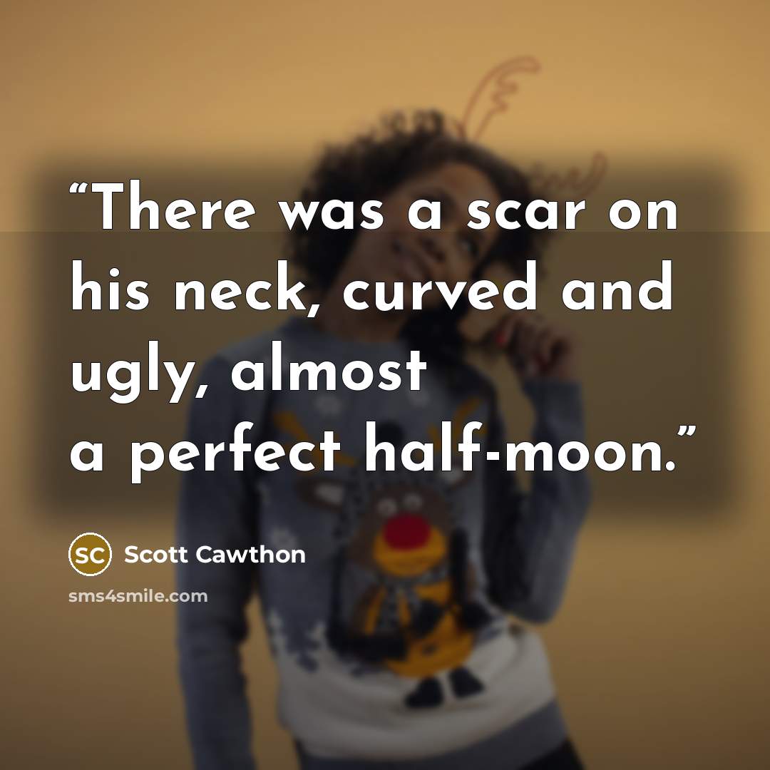 “There was a scar on his neck, curved and ugly, almost a perfect half-moon.” quote by Scott Cawthon