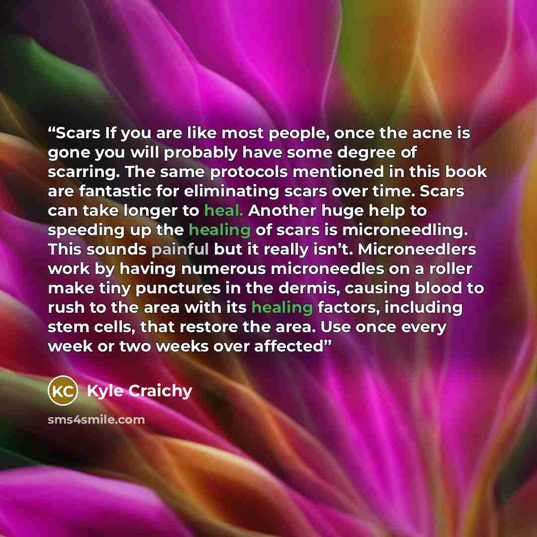“Scars If you are like most people, once the acne is gone you will probably have some degree of scarring. The same protocols mentioned in this book are fantastic for eliminating scars over time. Scars can take longer to heal. Another huge help to speeding up the healing of scars is microneedling…” quote by Kyle Craichy