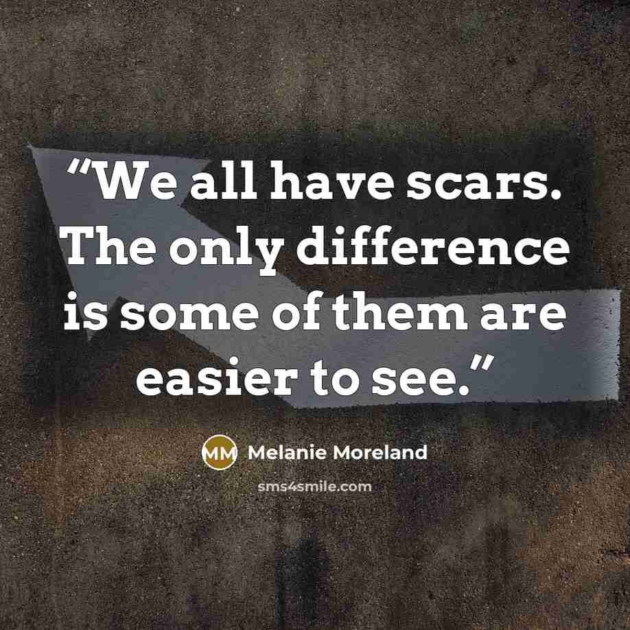 “We all have scars. The only difference is some of them are easier to see.” quote by Melanie Moreland