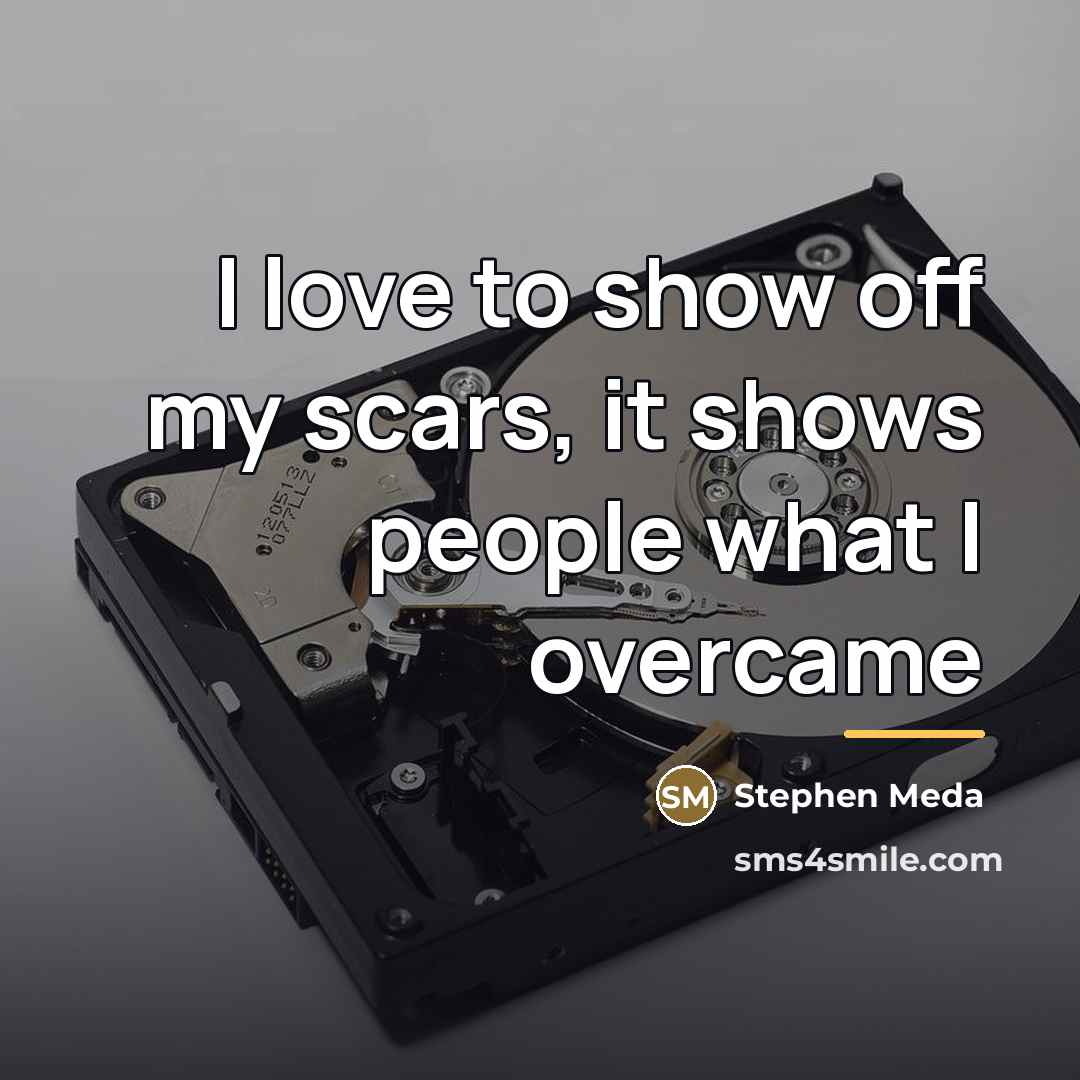 “I love to show off my scars, it shows people…” quote by Stephen Meda