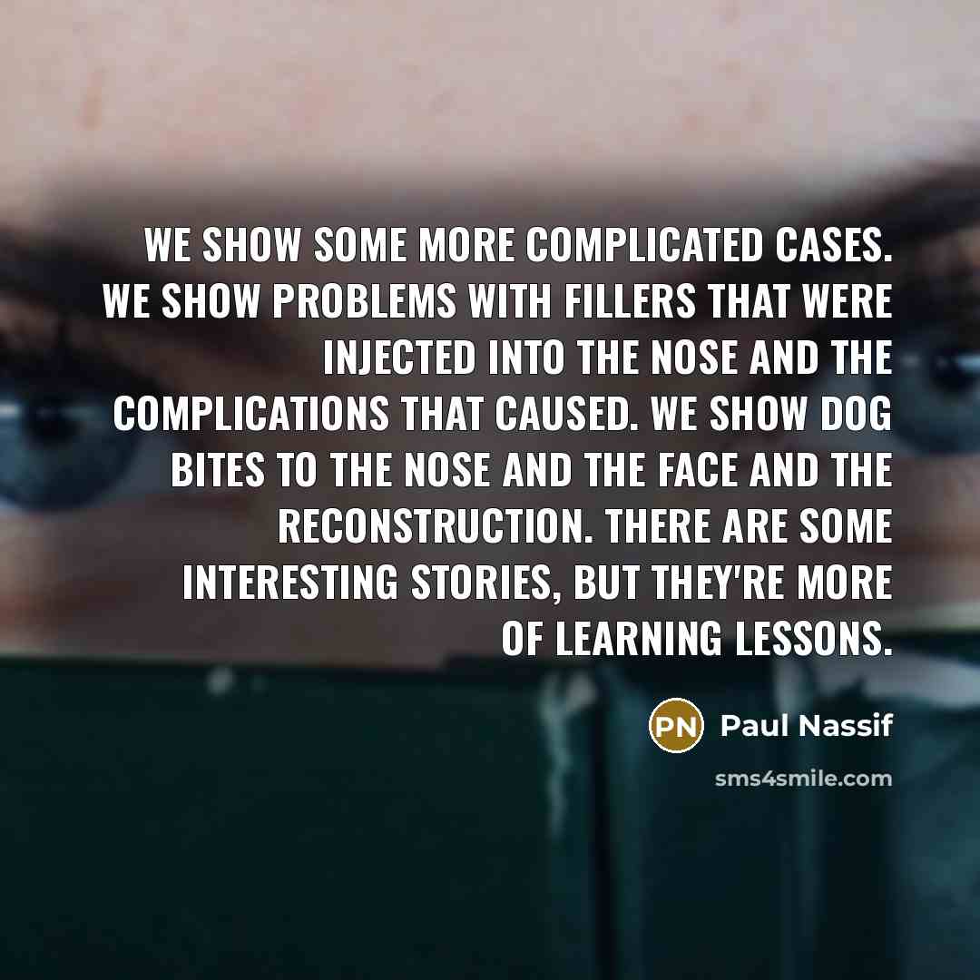 “We show some more complicated cases. We show problems with…” quote by Paul Nassif