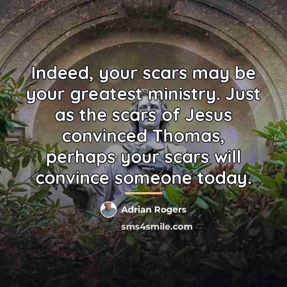 “Indeed, your scars may be your greatest ministry. Just as…” quote by Adrian Rogers