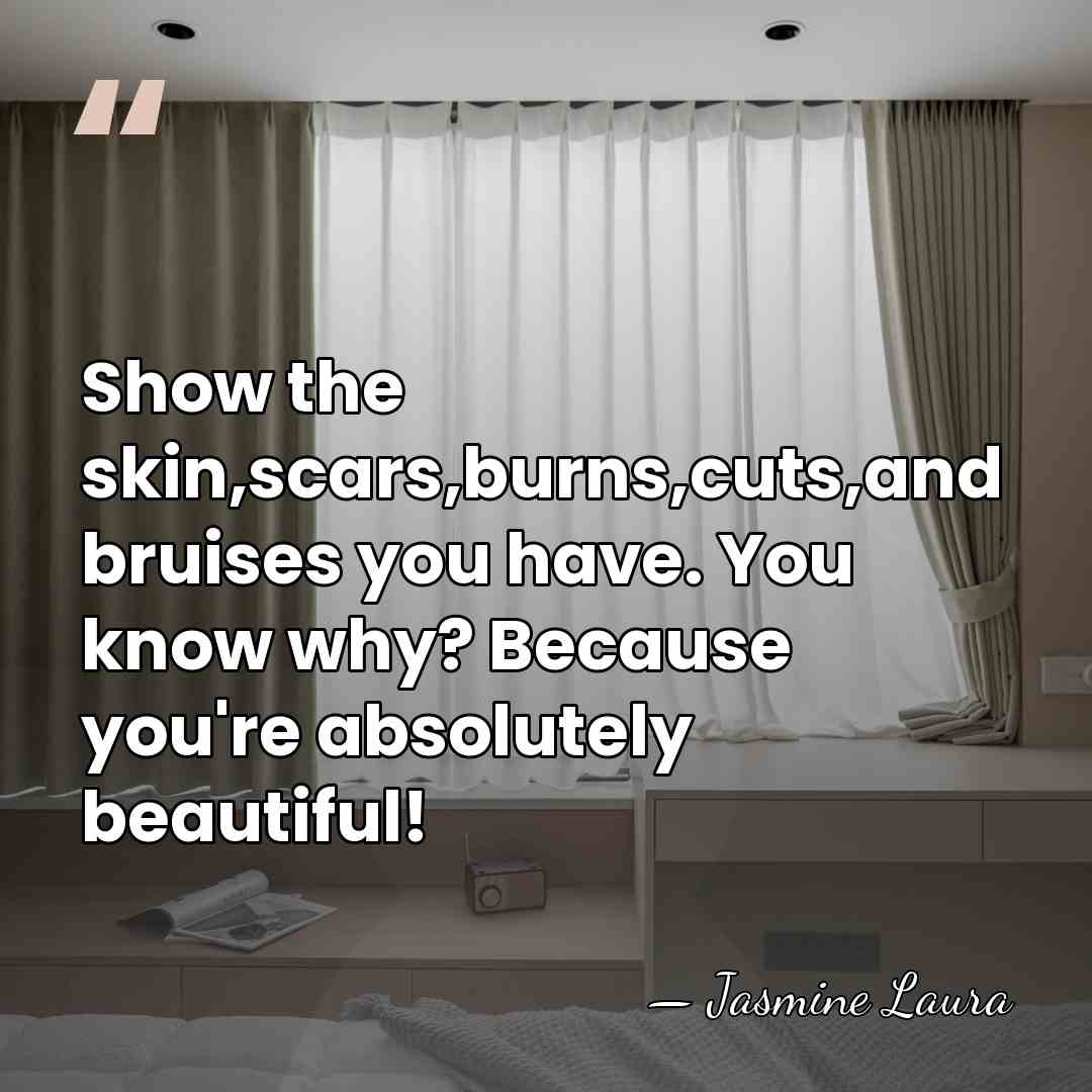 Show the skin,scars,burns,cuts,and bruises you have. You know why? Because you're absolutely&hellip; - Jasmine Laura