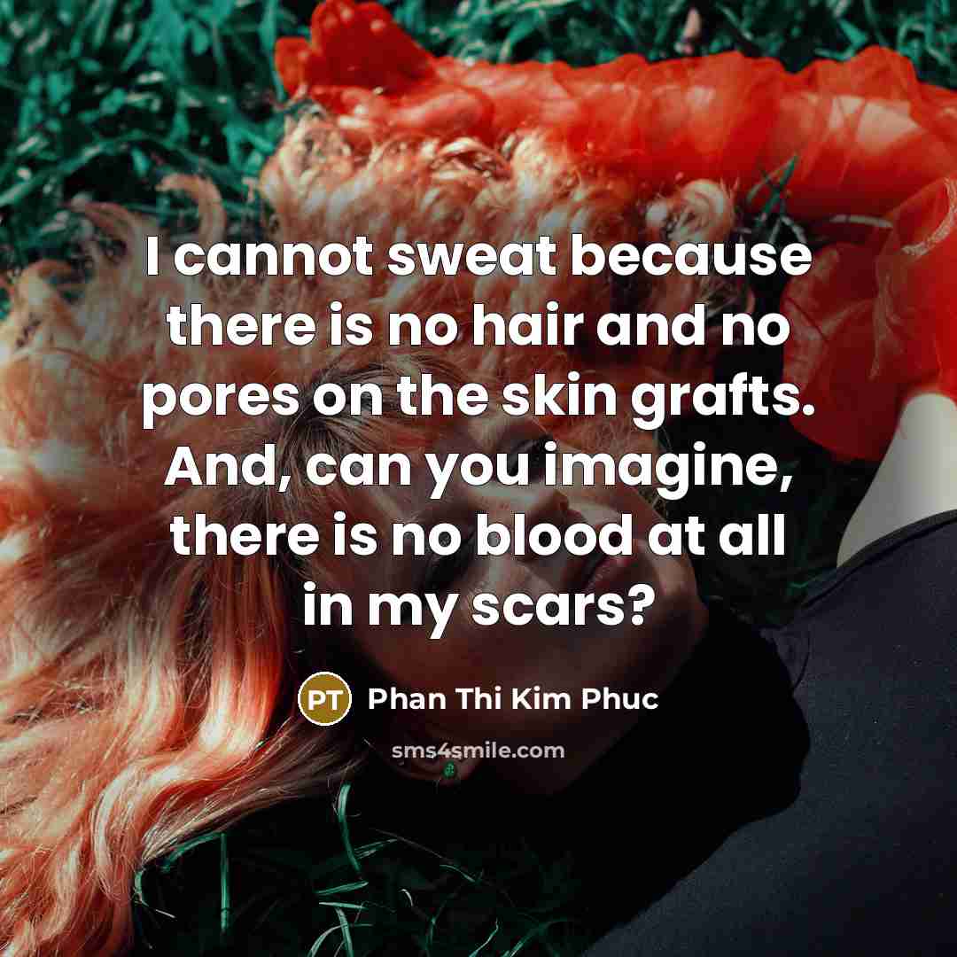 “I cannot sweat because there is no hair and no…” quote by Phan Thi Kim Phuc