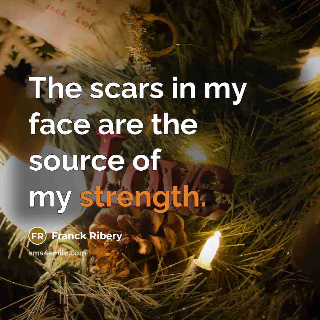 “The scars in my face are the source of my…” quote by Franck Ribery