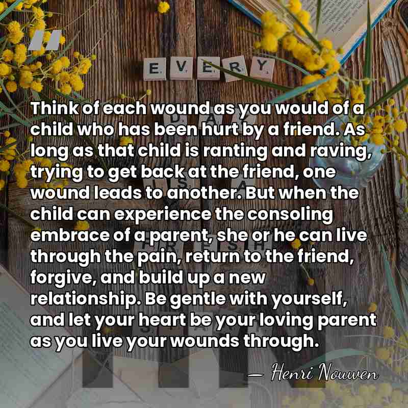 Think of each wound as you would of a child who has&hellip; - Henri Nouwen