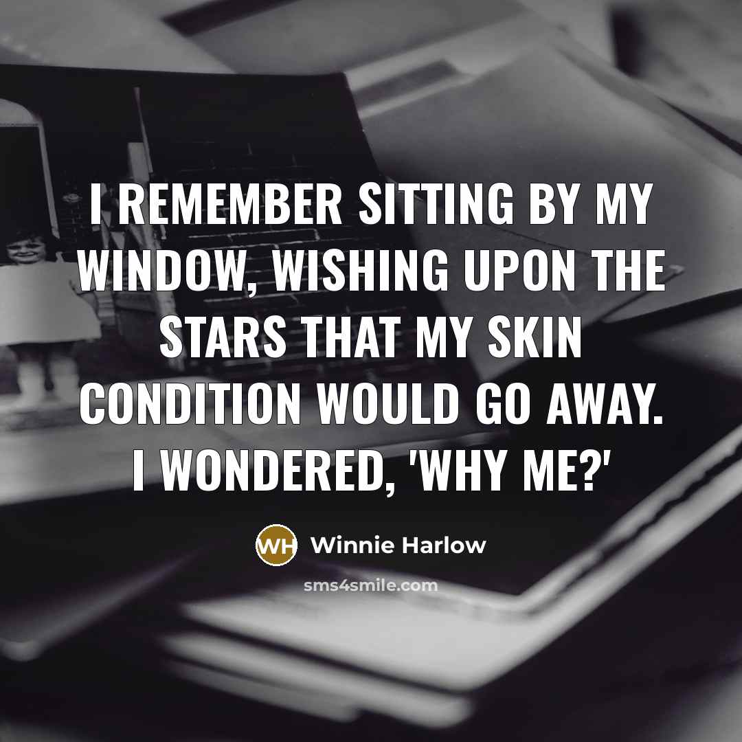 “I remember sitting by my window, wishing upon the stars…” quote by Winnie Harlow