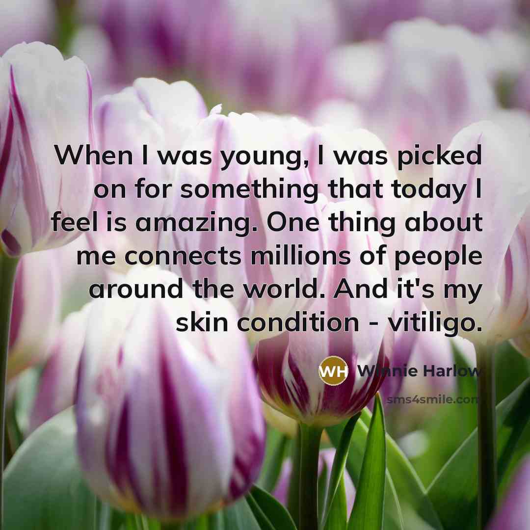 “When I was young, I was picked on for something…” quote by Winnie Harlow