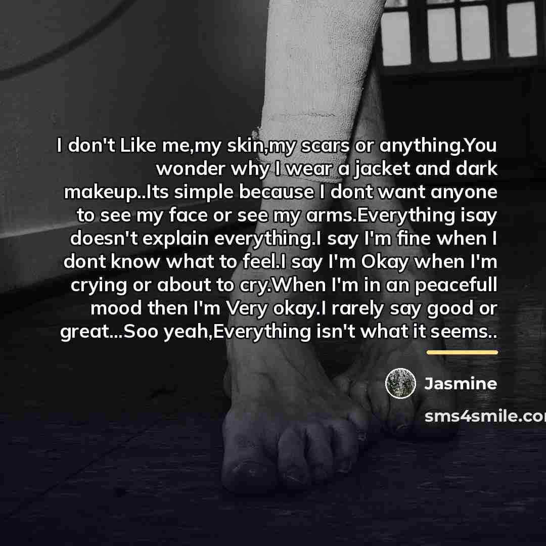 “I don't Like me,my skin,my scars or anything.You wonder why…” quote by Jasmine