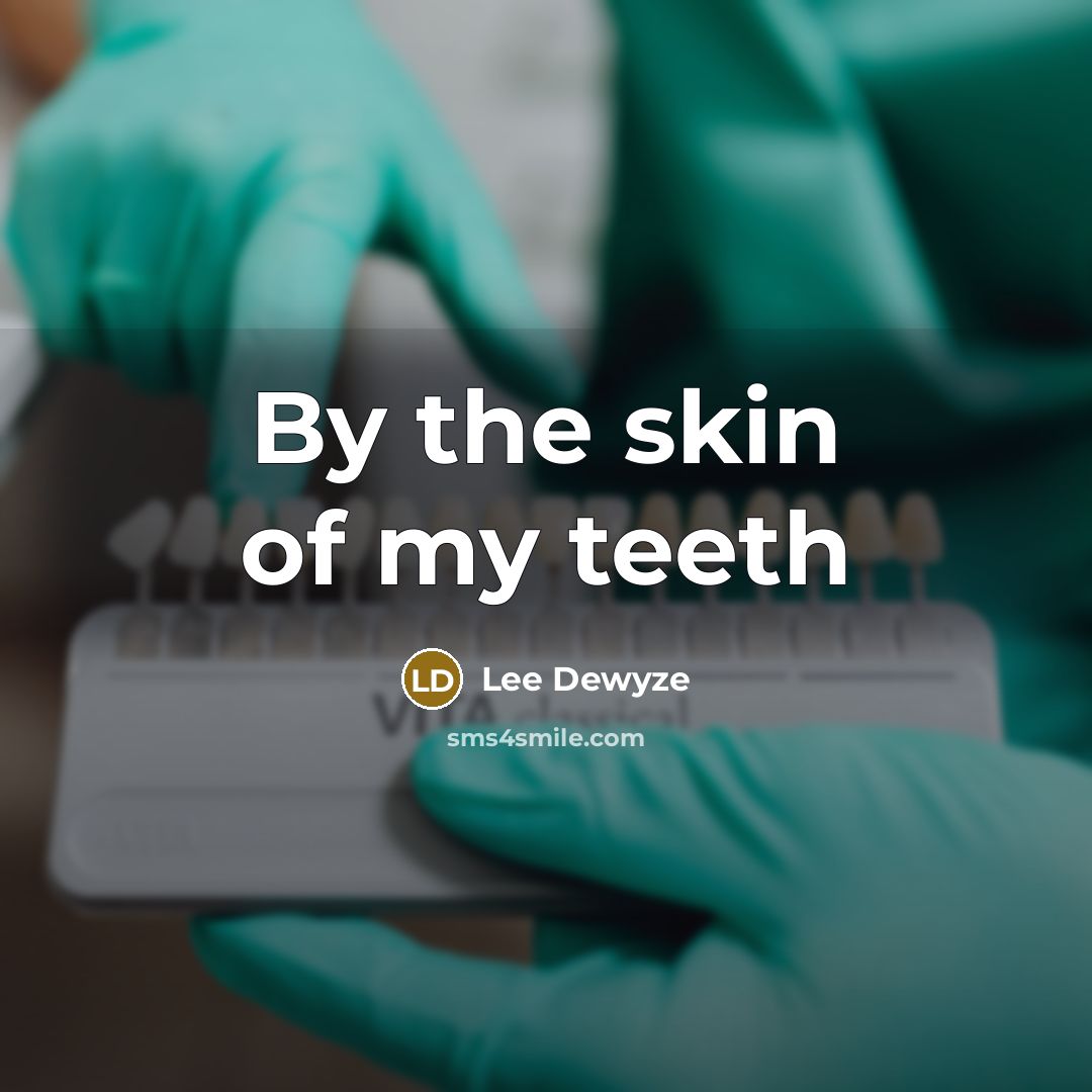 “By the skin of my teeth” quote by Lee Dewyze