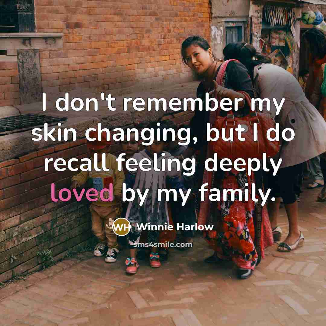 “I don't remember my skin changing, but I do recall…” quote by Winnie Harlow