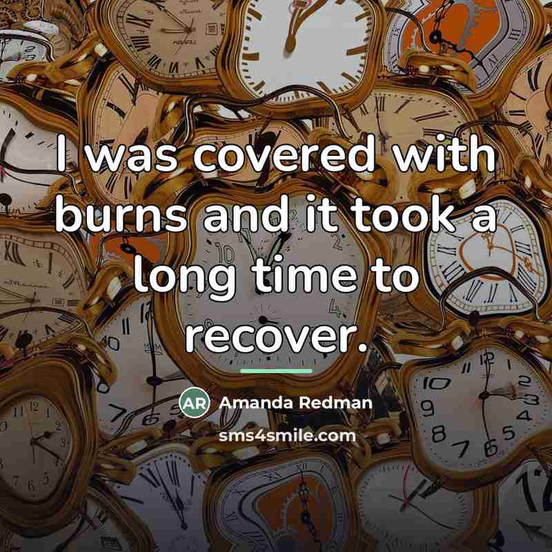 “I was covered with burns and it took a long…” quote by Amanda Redman