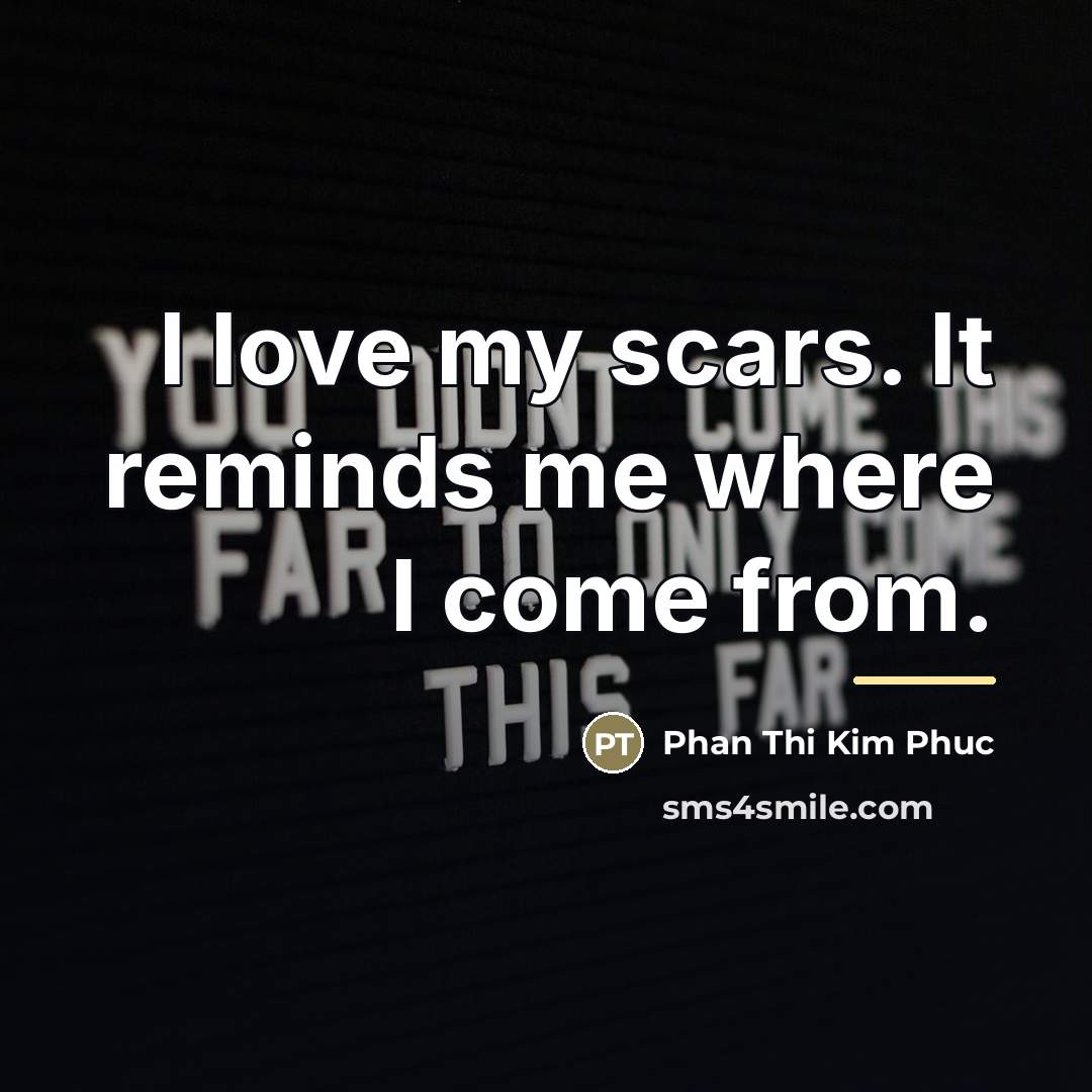“I love my scars. It reminds me where I come…” quote by Phan Thi Kim Phuc