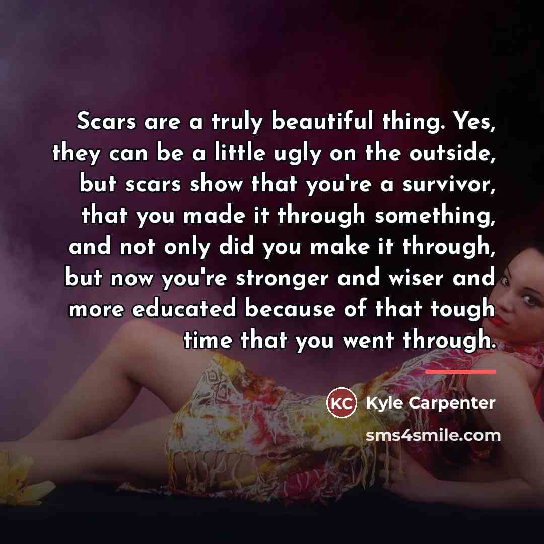 “Scars are a truly beautiful thing. Yes, they can be…” quote by Kyle Carpenter