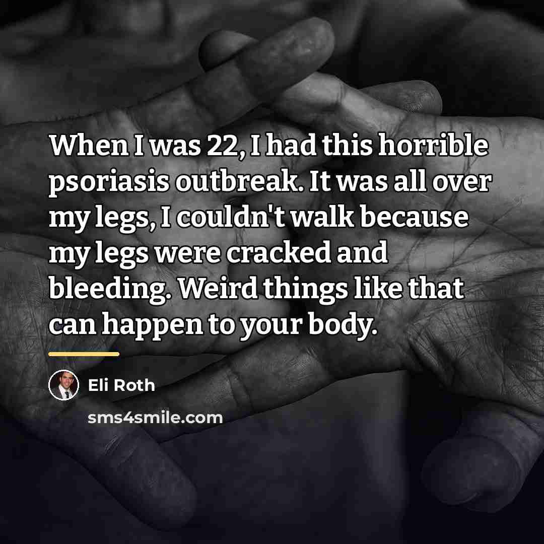 “When I was 22, I had this horrible psoriasis outbreak.…” quote by Eli Roth