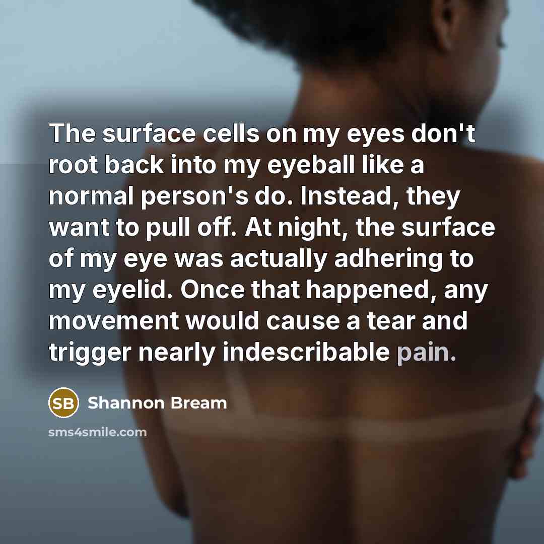 “The surface cells on my eyes don't root back into…” quote by Shannon Bream