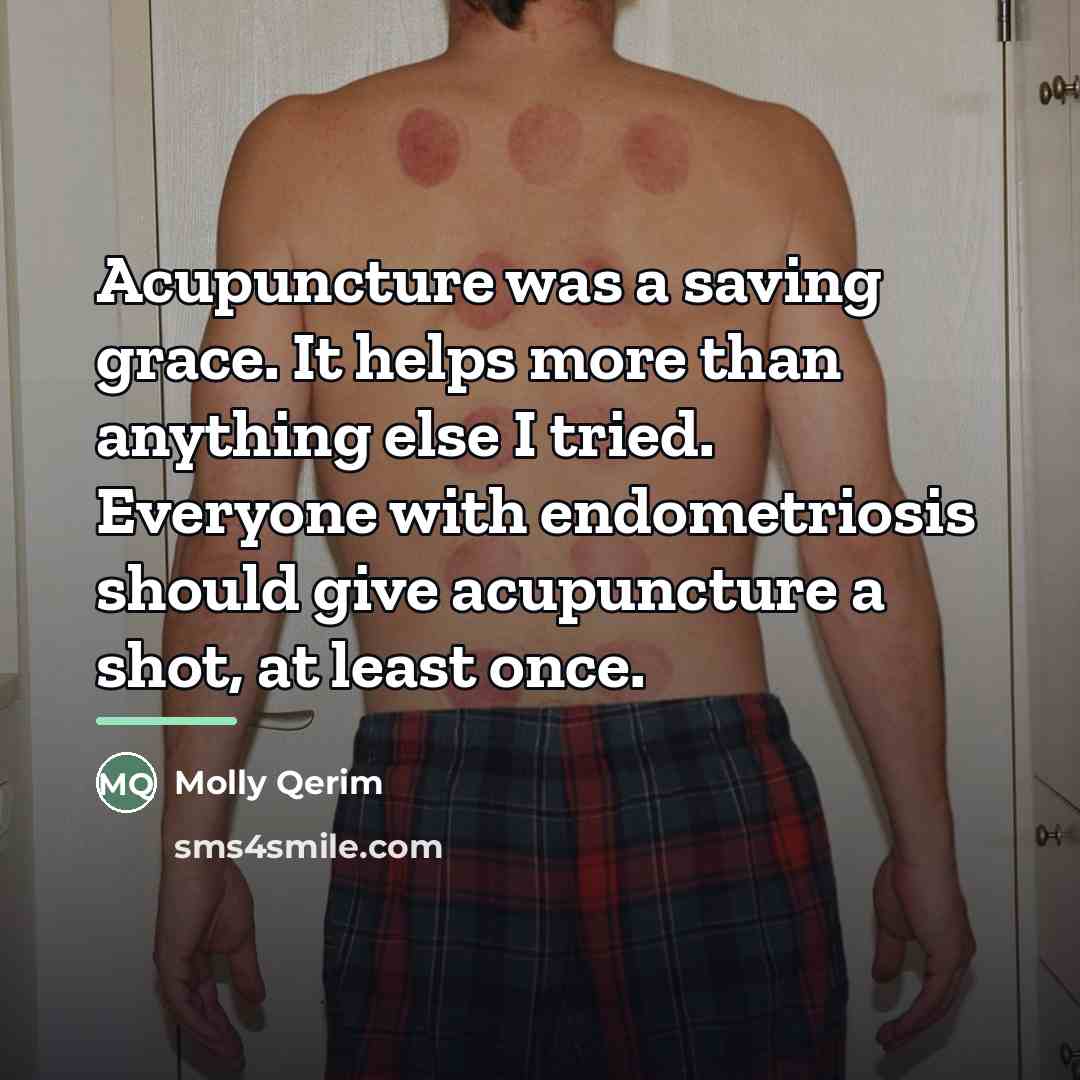 “Acupuncture was a saving grace. It helps more than anything…” quote by Molly Qerim