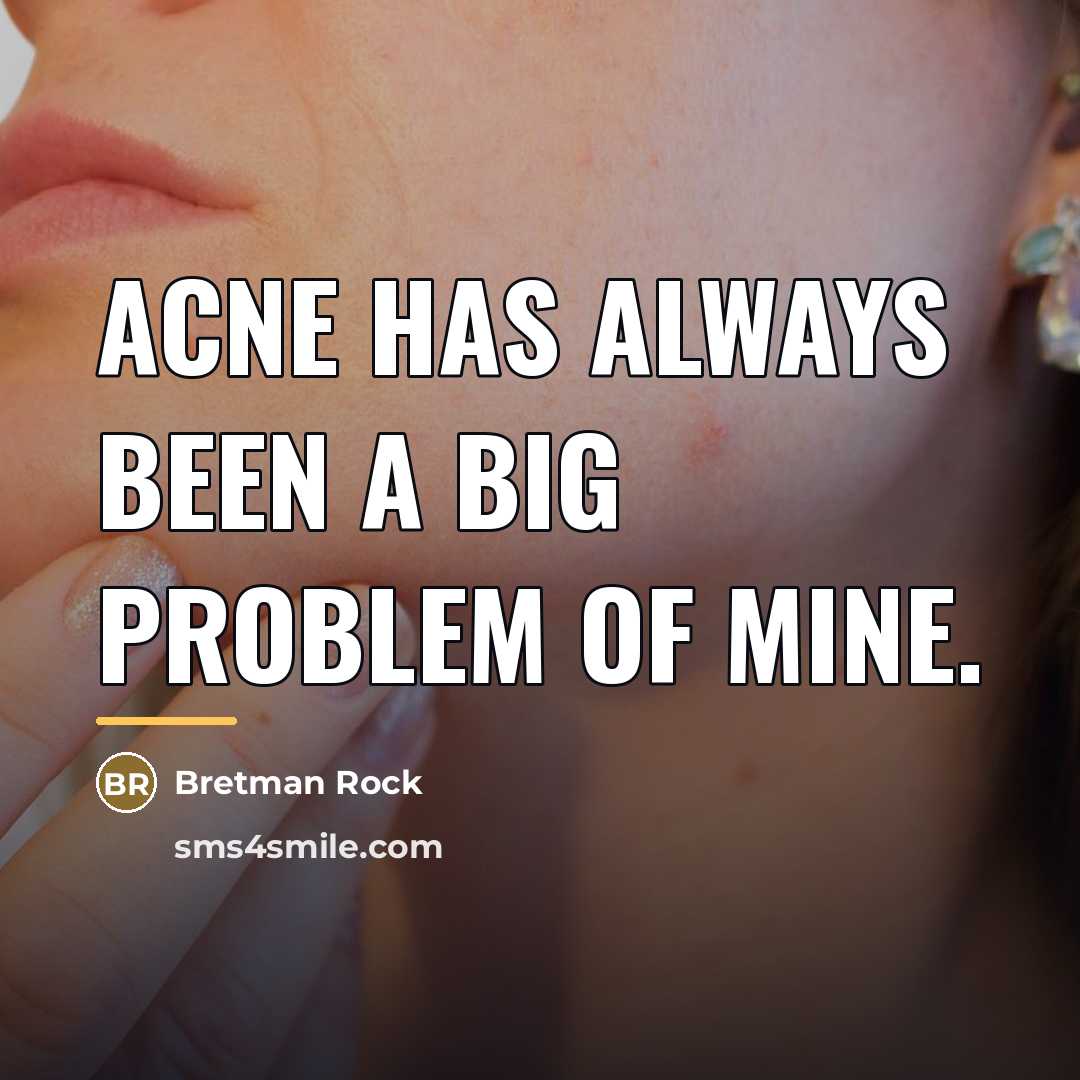 “Acne has always been a big problem of mine.…” quote by Bretman Rock