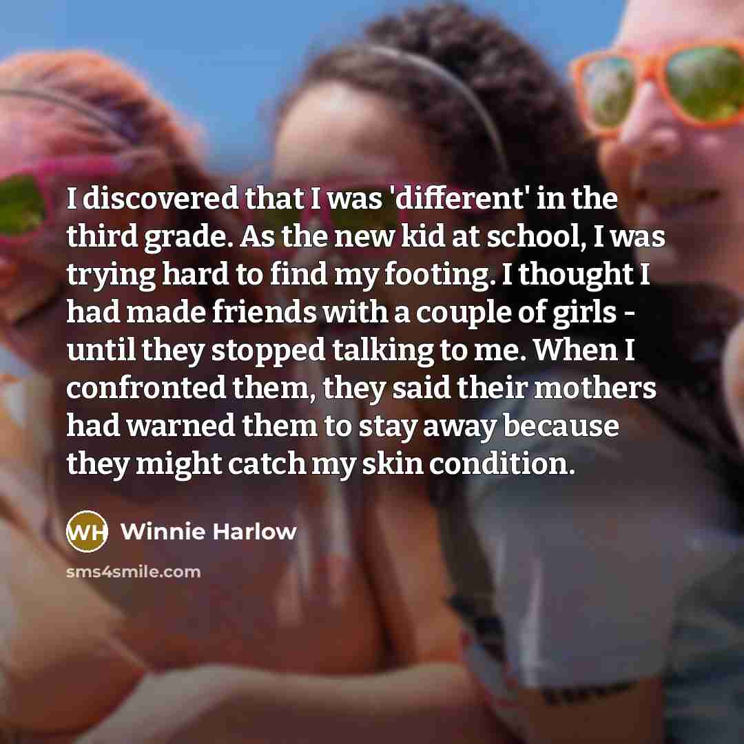 “I discovered that I was 'different' in the third grade.…” quote by Winnie Harlow