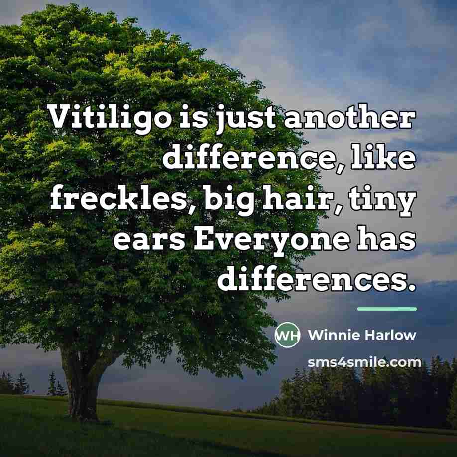 “Vitiligo is just another difference, like freckles, big hair, tiny…” quote by Winnie Harlow