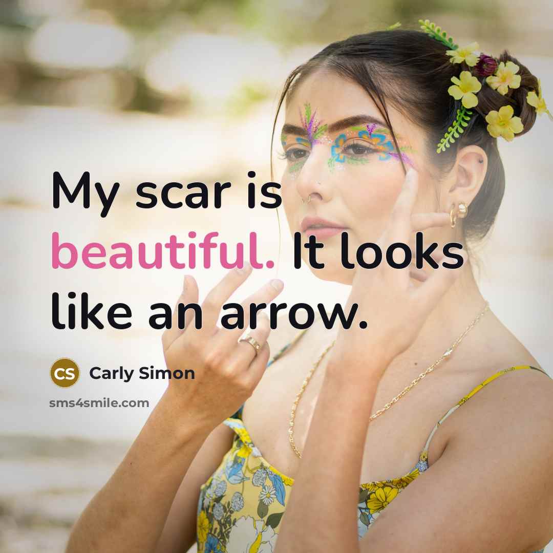 “My scar is beautiful. It looks like an arrow.…” quote by Carly Simon